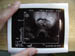 020531_ryan36_this_is_remo_and_wendys_baby